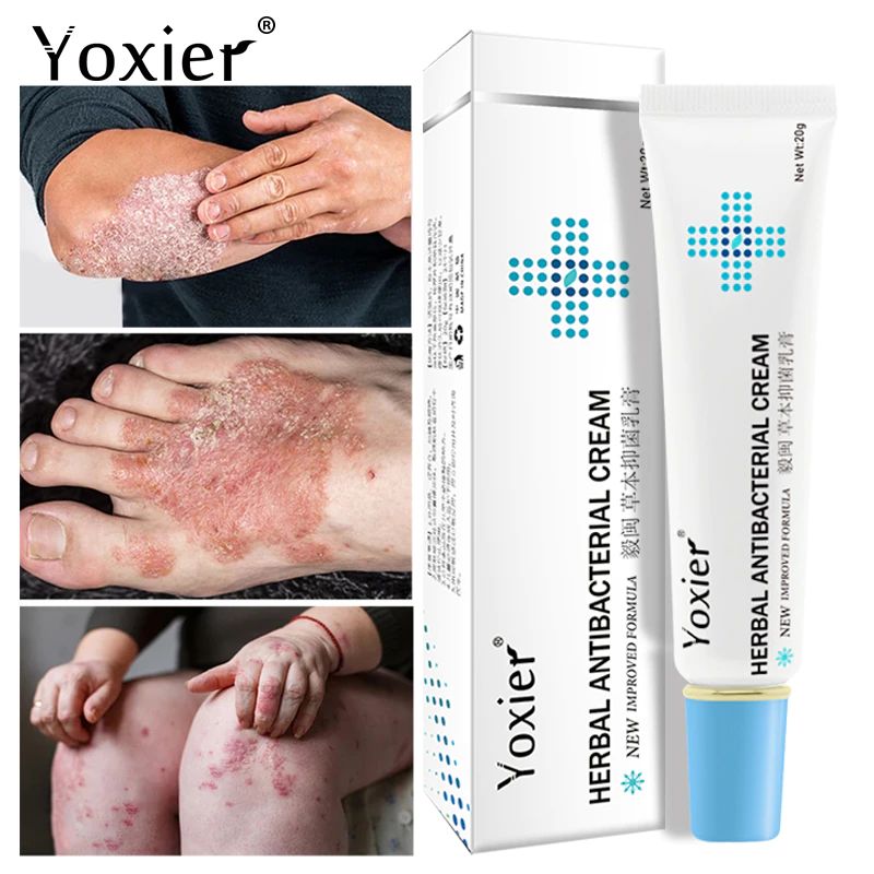 Yoxier Herbal Antibacterial Cream Psoriasis Cream Anti Itch Relief