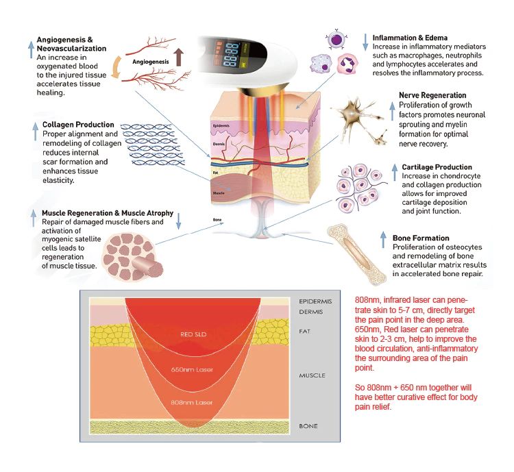 彩色疼痛仪(红黄蓝)_08