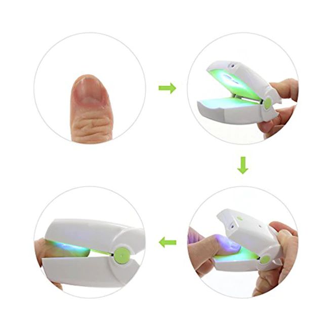 Rechargeable-Nail-Fungus-Laser-Treatment-Device-Cure-Onychomycosis-Professional-Toe-Finger-Nail-Fungus-Treatment-Machine